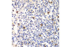 Immunohistochemistry of paraffin-embedded mouse spleen using PSMD7 antibody (ABIN5973092) at dilution of 1/100 (40x lens). (PSMD7 抗体)