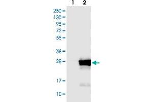 Western blot analysis of Lane 1: Negative control (vector only transfected HEK293T lysate), Lane 2: Over-expression Lysate (Co-expressed with a C-terminal myc-DDK tag (~3. (COMMD9 抗体)