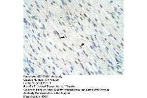 Human Muscle (SERTAD1 抗体  (N-Term))