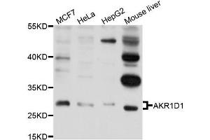 Western blot analysis of extracts of various cell lines, using AKR1D1 antibody (ABIN5995883) at 1/1000 dilution. (AKR1D1 抗体)