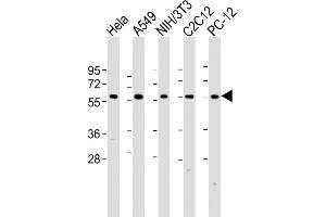 Western Blotting (WB) image for anti-Pyruvate Kinase M2 (PKM2) (AA 476-505), (C-Term) antibody (ABIN391053)
