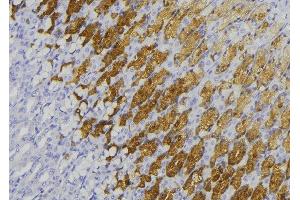 ABIN6278469 at 1/100 staining Human gastric tissue by IHC-P. (GUCY1B2 抗体)