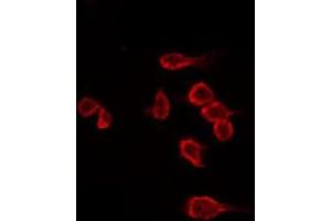 ABIN6266530 staining Hela by IF/ICC. (Dysferlin 抗体  (C-Term))