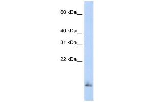 WB Suggested Anti-SCGB1A1 Antibody Titration:  0. (SCGB1A1 抗体  (Middle Region))