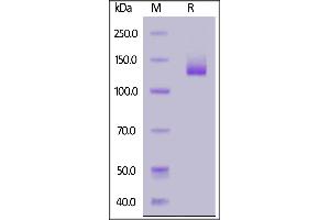 Fed Human NCAM-1, Fc Tag on  under reducing (R) condition. (CD56 Protein (AA 20-718) (Fc Tag,FITC))