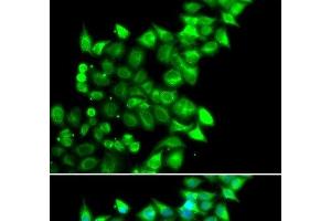 Immunofluorescence analysis of U2OS cells using MEST Polyclonal Antibody (MEST 抗体)