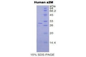SDS-PAGE (SDS) image for alpha-2-Macroglobulin (A2M) (AA 616-856) protein (His tag) (ABIN1878330) (alpha 2 Macroglobulin Protein (AA 616-856) (His tag))