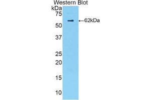 Western blot analysis of the recombinant protein. (Complement Factor B 抗体  (AA 34-159))