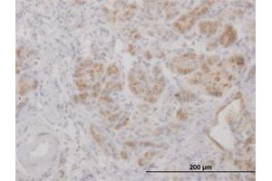 Immunoperoxidase of purified MaxPab antibody to LCN2 on formalin-fixed paraffin-embedded human pancreas.