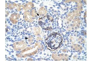 CLIC5 antibody was used for immunohistochemistry at a concentration of 4-8 ug/ml to stain Epithelial cells of renal tubule (arrows) in Human Kidney. (CLIC5 抗体  (C-Term))