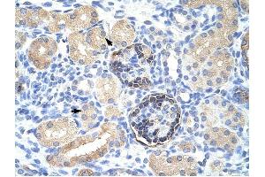 CLIC5 antibody was used for immunohistochemistry at a concentration of 4-8 ug/ml to stain Epithelial cells of renal tubule (arrows) in Human Kidney.