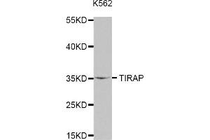 Western Blotting (WB) image for anti-Toll-Interleukin 1 Receptor (TIR) Domain Containing Adaptor Protein (TIRAP) antibody (ABIN1875100) (TIRAP 抗体)