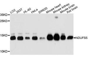 Western blot analysis of extracts of mouse liver tissue lines, using NDUFS5 antibody. (NDUFS5 抗体)