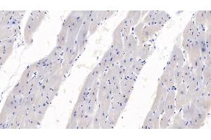 Immunohistochemistry (IHC) image for anti-Sema Domain, Immunoglobulin Domain (Ig), Short Basic Domain, Secreted, (Semaphorin) 3A (SEMA3A) (AA 580-664) antibody (ABIN7428446)