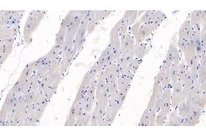 Detection of SEMA3A in Human Heart Tissue using Monoclonal Antibody to Semaphorin 3A (SEMA3A) (SEMA3A 抗体  (AA 580-664))