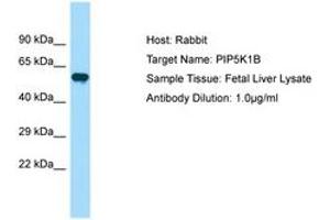 Image no. 1 for anti-Phosphatidylinositol-4-Phosphate 5-Kinase, Type I, beta (PIP5K1B) (AA 395-444) antibody (ABIN6750033) (PIP5K1B 抗体  (AA 395-444))