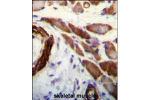 FLNA Antibody (Y1046) immunohistochemistry analysis in formalin fixed and paraffin embedded human skeletal muscle followed by peroxidase conjugation of the secondary antibody and DAB staining. (Filamin A 抗体  (AA 1025-1054))