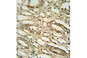 Immunohistochemistry analysis in formalin fixed and paraffin embedded human lung tissue reacted with GGTLC2 Antibody (Center) followed peroxidase conjugated to the secondary antibody and followed by DAB staining. (GGTLC2 抗体  (Middle Region))