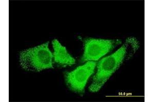 Immunofluorescence of monoclonal antibody to SCYE1 on HeLa cell. (AIMP1 抗体  (AA 1-312))