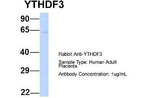 Western Blotting (WB) image for anti-YTH Domain Family, Member 3 (YTHDF3) (N-Term) antibody (ABIN2786250)