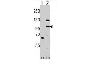 Western blot analysis of MLK4 (arrow) using rabbit MLK4 polyclonal antibody . (MLK4 抗体  (N-Term))