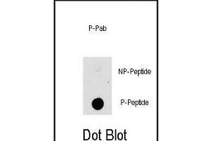 Dot blot analysis of anti-K1-p Phospho-specific b (ABIN389799 and ABIN2839695) on nitrocellulose membrane. (MAP3K8 抗体  (pThr290))