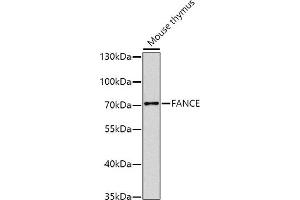 Western blot analysis of extracts of mouse thymus, using FANCE antibody (ABIN6129378, ABIN6140472, ABIN6140473 and ABIN6224472) at 1:1000 dilution. (FANCE 抗体  (AA 1-255))
