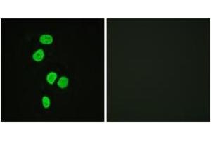 Immunofluorescence analysis of HeLa cells, using AS160 (Ab-642) Antibody. (TBC1D4 抗体  (AA 611-660))