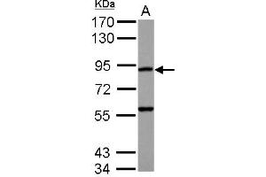 Western Blotting (WB) image for anti-RAS P21 Protein Activator 4 (RASA4) (N-Term) antibody (ABIN1494072) (RASA4 抗体  (N-Term))