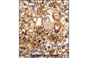 Immunohistochemistry (Paraffin-embedded Sections) (IHC (p)) image for anti-Complement Component 6 (C6) (AA 30-58), (N-Term) antibody (ABIN390924)
