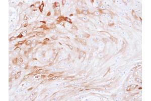 Immunohistochemistry (IHC) image for anti-Branched Chain Amino-Acid Transaminase 2, Mitochondrial (BCAT2) (Center) antibody (ABIN2855776)