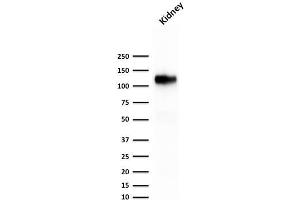 Western Blot Analysis of human kidney tissue lysate using KSP-Cadherin Recombinant Mouse Monoclonal Antibody (rCDH16/1071). (Recombinant Cadherin-16 抗体)