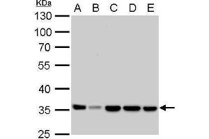 WB Image LDHA antibody detects LDHA protein by Western blot analysis. (Lactate Dehydrogenase A 抗体)
