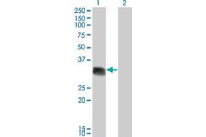 Western Blot analysis of SCML1 expression in transfected 293T cell line by SCML1 monoclonal antibody (M01), clone 4G3.