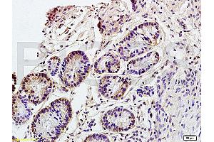 Immunohistochemistry (IHC) image for anti-Solute Carrier Family 3 (Activators of Dibasic and Neutral Amino Acid Transport), Member 2 (SLC3A2) (AA 231-280) antibody (ABIN719546)