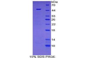 SDS-PAGE analysis of Mouse HYAL1 Protein. (HYAL1 蛋白)