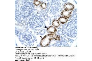 Human kidney (EIF2AK2 抗体  (C-Term))
