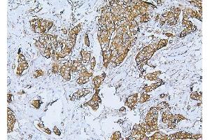 IHC analysis of Filamin B/FLNB using anti-Filamin B/FLNB antibody (ABIN7601607). (FLNB 抗体  (AA 397-701))