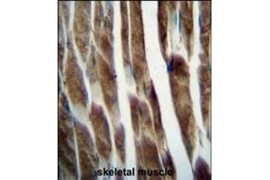 ILK Antibody (Center) 5884c immunohistochemistry analysis in formalin fixed and paraffin embedded human skeletal muscle followed by peroxidase conjugation of the secondary antibody and DAB staining. (ILKAP 抗体  (AA 243-270))