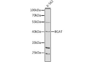Western blot analysis of extracts of K-562 cells, using BGAT antibody (ABIN3022190, ABIN3022191, ABIN3022192 and ABIN6218658) at 1:1000 dilution. (ABO 抗体  (AA 54-354))