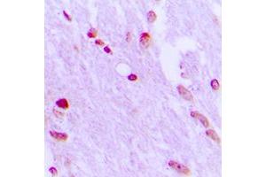 Immunohistochemistry (IHC) image for anti-Apoptosis-Inducing Factor, Mitochondrion-Associated, 1 (AIFM1) (N-Term) antibody (ABIN7297528)