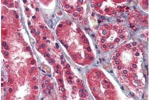 Human Kidney: Formalin-Fixed, Paraffin-Embedded (FFPE) (AIF 抗体  (AA 593-606))