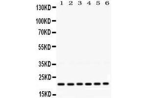 Western Blotting (WB) image for anti-RAB10, Member RAS Oncogene Family (RAB10) (AA 153-185), (C-Term) antibody (ABIN3043448) (RAB10 抗体  (C-Term))