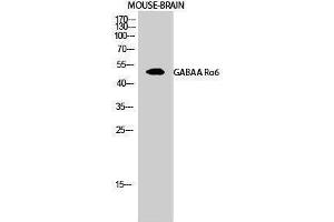 Western Blotting (WB) image for anti-gamma-aminobutyric Acid (GABA) A Receptor, alpha 6 (GABRA6) (Internal Region) antibody (ABIN3175195) (GABRA6 抗体  (Internal Region))