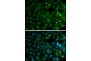 Immunofluorescence analysis of U2OS cells using HPD antibody. (HPD 抗体  (AA 1-393))