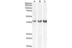 ABIN6391407 (0. (Homeobox D13 抗体  (Internal Region))