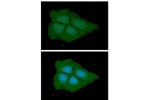 ICC/IF analysis of PGD in Hep3B cells line, stained with DAPI (Blue) for nucleus staining and monoclonal anti-human PGD antibody (1:100) with goat anti-mouse IgG-Alexa fluor 488 conjugate (Green). (PGD 抗体  (AA 1-483))