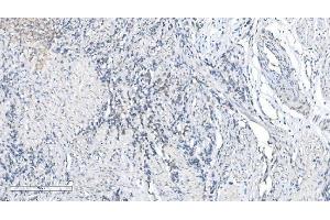 IHC analysis of METTL3 using anti-METTL3 antibody (ABIN7602808). (METTL3 抗体  (C-Term))