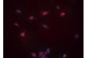 ABIN6276530 staining HeLa cells by ICC/IF. (Cardiac Troponin T2 抗体  (C-Term))