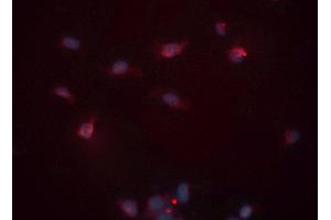 ABIN6276530 staining HeLa cells by ICC/IF. (Cardiac Troponin T2 抗体  (C-Term))